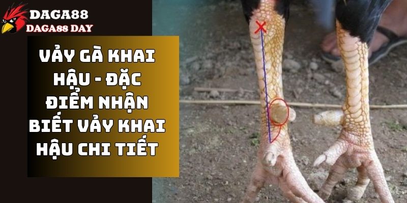 vảy gà khai hậu